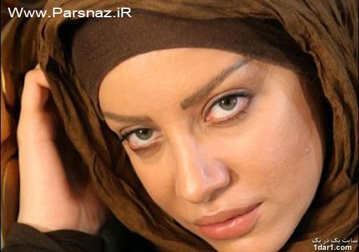 پشیمانی این خانم‌ مشهور ایرانی از عمل زیبایی‌(عکس)