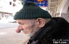 دراز ترین بینی متعلق به کیست؟+عکس دراز ترین بینی متعلق به کیست؟+عکس