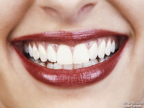 چگونه دندان های سفید و زیبا  داشته باشیم
