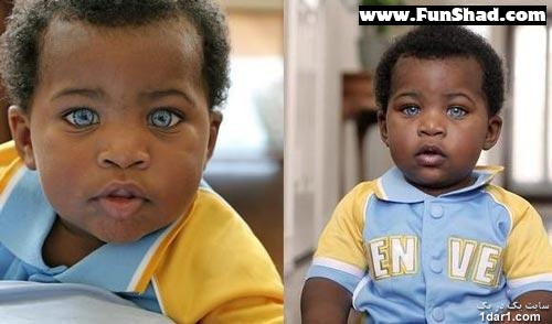 زیباترین چشم جهان متعلق به یک پسر آفریقایی است