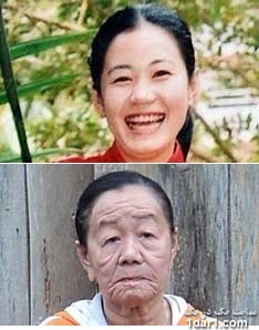 تصویر زنی که 3ساله 50سال پیرتر شد 