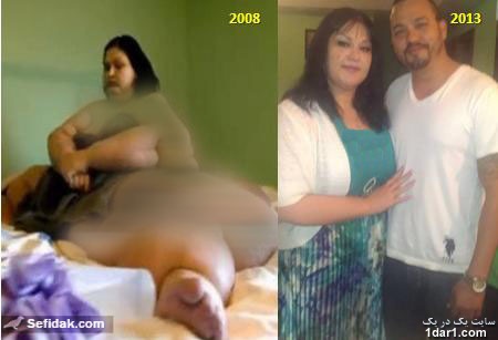 چاق ترین زن جهان فقط 300 کیلو لاغر شد+عکس